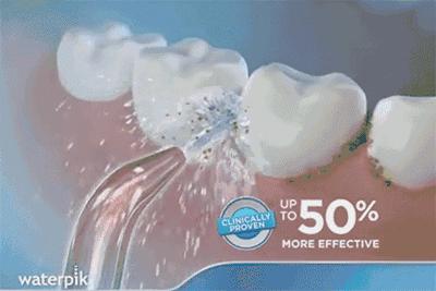 牙黄还不整齐，再美张嘴也输了你知道吗？