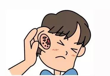 带孩子游泳后孩子耳屏疼,游泳时耳朵进水了有点疼怎么处理