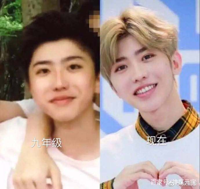 蔡徐坤整容？网友：你怕是瞎了吧！