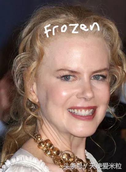 最新的整形塑形手术,7种整形手术可以尝试