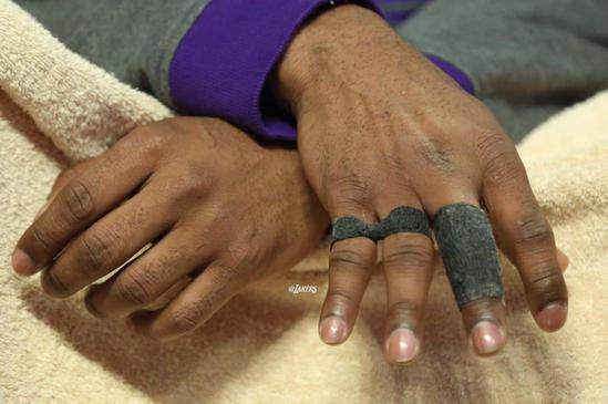 恐怖的手和脚趾!篮球给他们带来的“礼物”,你还会羡慕他们吗?