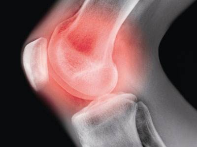 篮球运动损伤预防思路,篮球运动常见损伤及预防分析