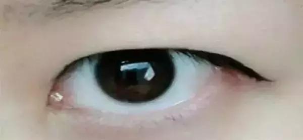 单眼皮肿眼泡无神怎么办,单眼皮肿眼泡眼妆怎么化