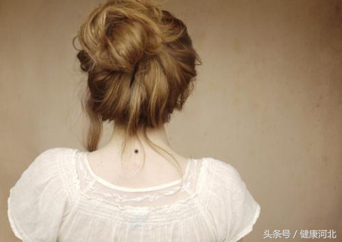 手背后期形成的痣怎么处理,痣的表皮抠掉了会长出突出的痣吗