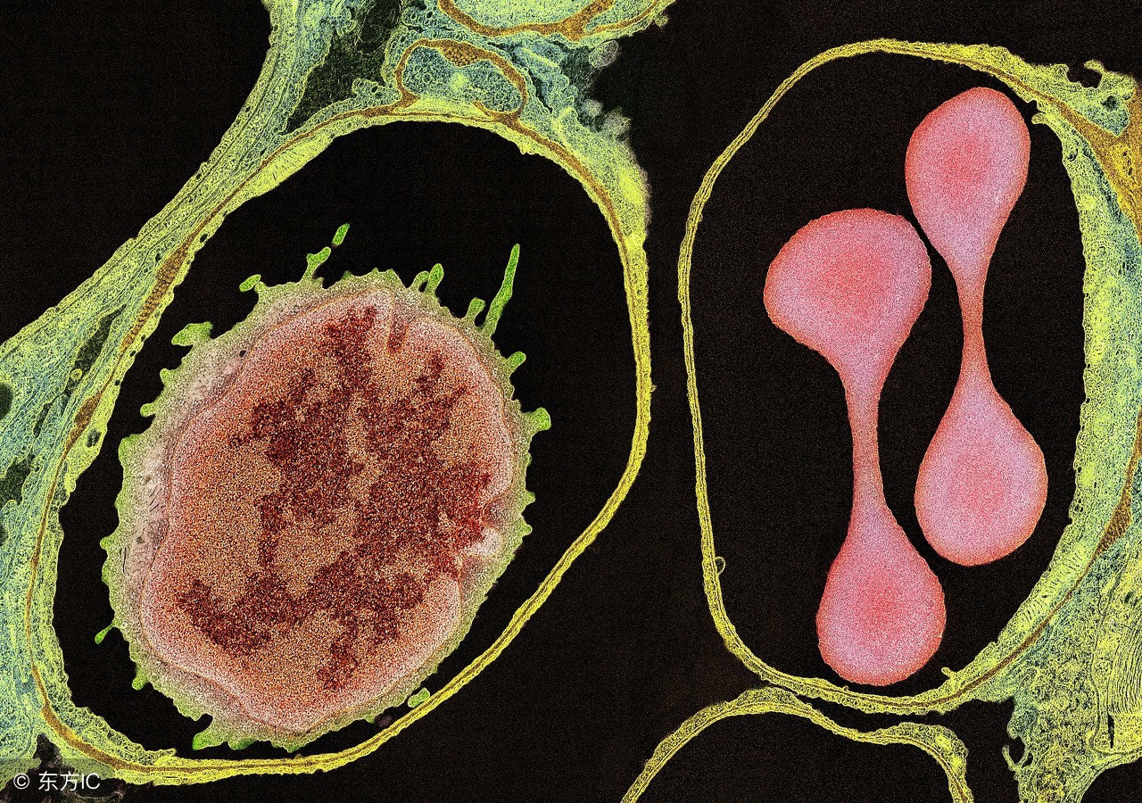 怎么判断肺大泡严不严重？不治疗会自愈吗？