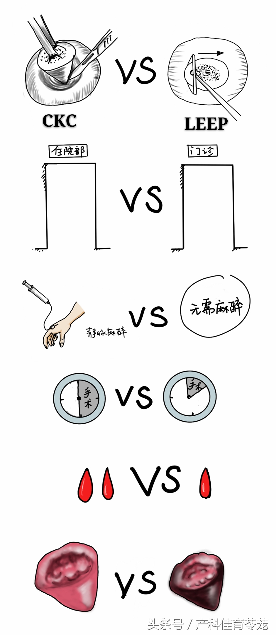 宫颈锥切术后还会得宫颈癌吗,做了宫颈锥切术后还能怀孕吗