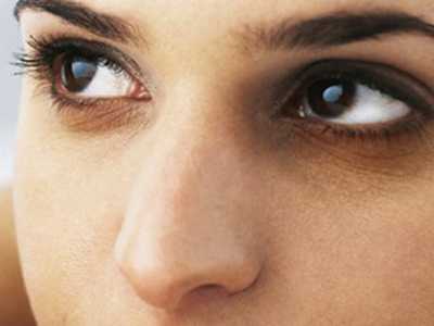 怎样去除黑眼圈眼袋细纹,怎样去除黑眼圈男生