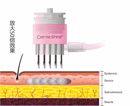 深度剖析医美整形的危害,医美整形该如何避坑呢