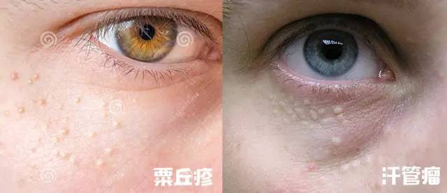 深扒护肤品内幕,深扒面膜那些事