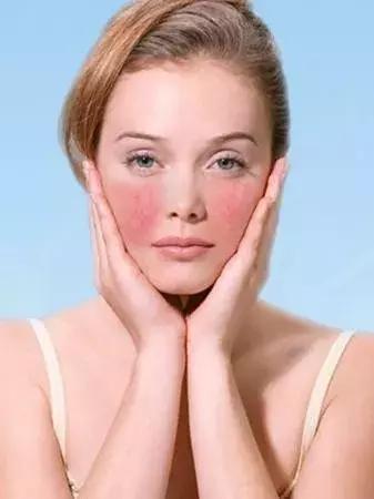 挤黑头痘痘粉刺闭口,怎么去除闭口痘