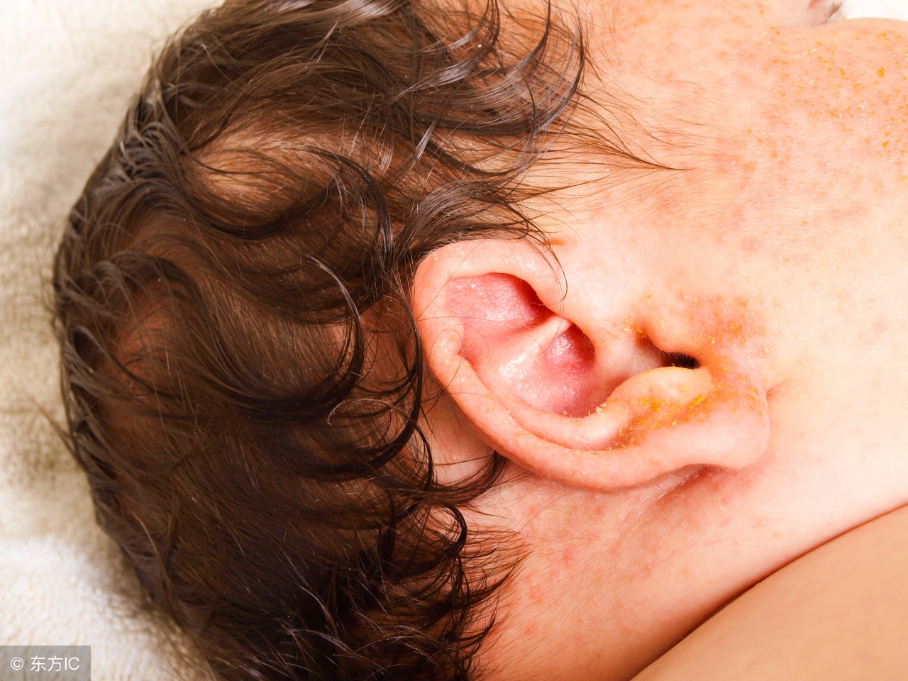 脸部发黄身上起疹子是药物中毒吗,宝宝身上皮肤白脸上暗黄怎么回事