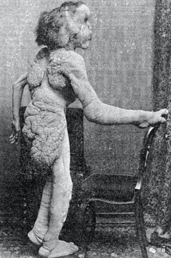 我看了场大尺度畸形人体秀，从此再也没睡过安稳觉！