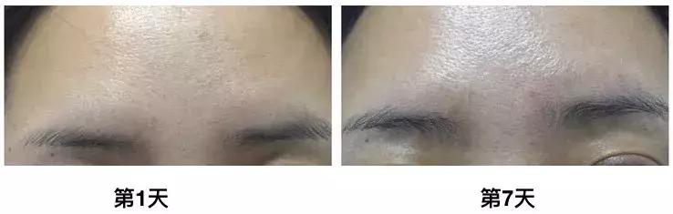 不吹不黑｜这款cosme大赏NO.1的逆龄精华好用吗？