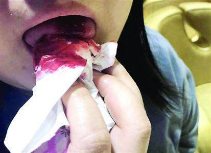 吃哈根达斯满嘴是血,哈根达斯吃出满嘴血