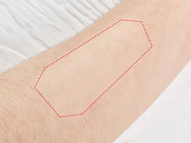 除毛膏永久去除,彻底去除毛根的脱毛膏