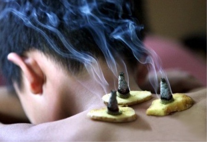 艾灸适合寒性体质吗,艾灸适合湿热体质吗