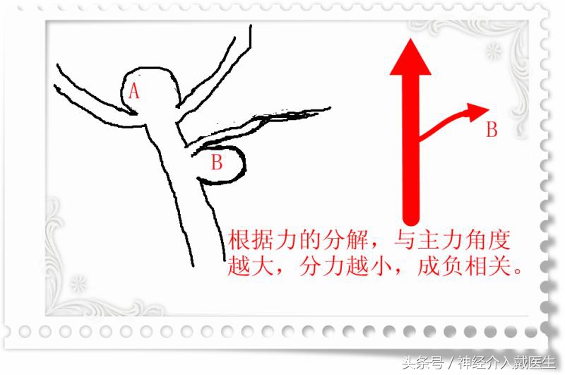 关于动脉瘤的治疗有几种方法,颅内动脉瘤的最新指南和共识