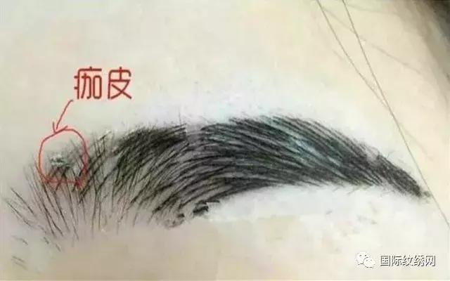 半永久眉失败了怎么办,半永久眉毛眉形不好怎么办