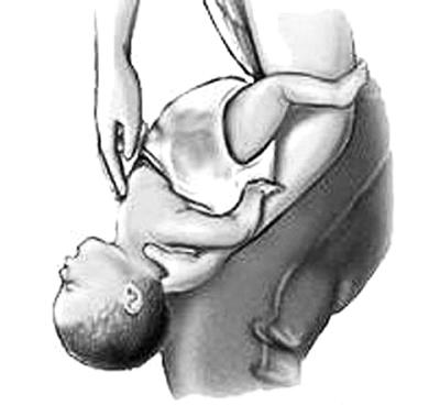 男童卡喉被过路医生救回,男童被卡喉医生15秒救命