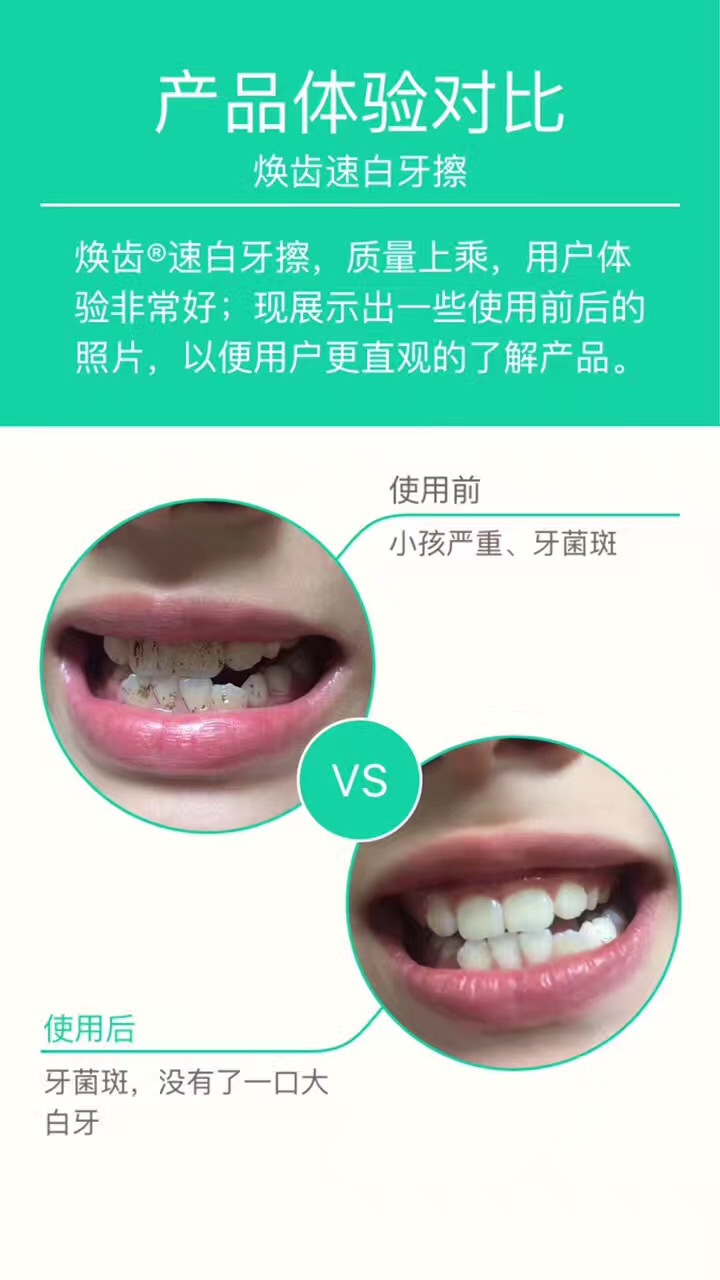 牙齿美白速效去黄牙烟渍神器,清洁牙渍美白牙齿