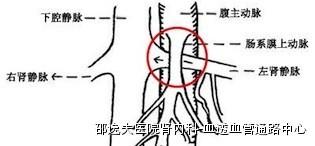宝宝反复血尿查了一圈，最后发现是“胡桃夹”作怪，您听说过吗？