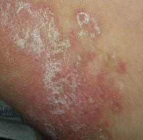 洁尔阴洗剂，男人用了效果也不赖！