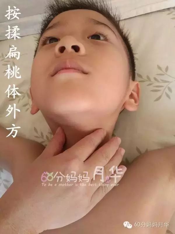 扁桃体炎引起的高烧不退咽喉脓肿，只能靠吃药吗？！