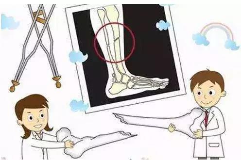 骨折康复期间的护理知识,骨折中医康复好还是西医康复好