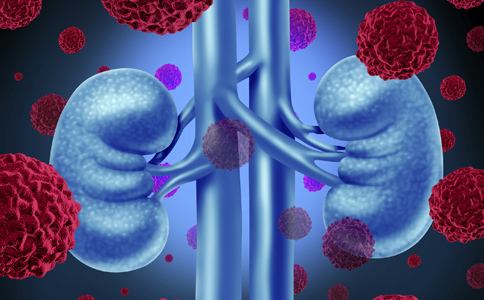 糖尿病的危害真实案例,关于糖尿病最常见的十个误解