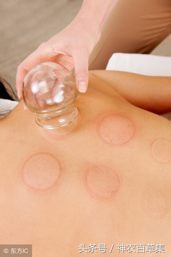 拔罐减肥开穴和封穴分别怎么操作,拔罐穴位学习全套