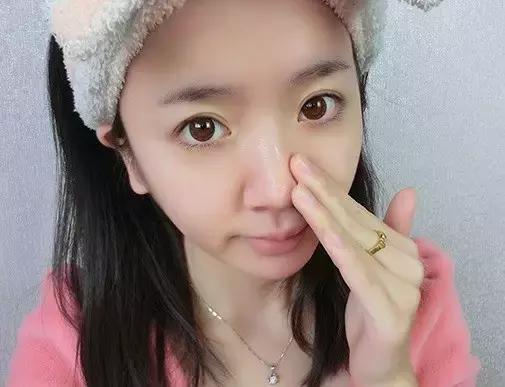 鼻子黑头多毛孔粗大出油怎么办,鼻子黑头出油怎么办小窍门