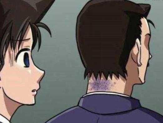 名侦探柯南惨遭四次杀害的凶手,名侦探柯南中被打得最惨嫌疑人