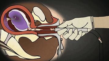 男朋友发微信来如何高情商回复,微信套路回复