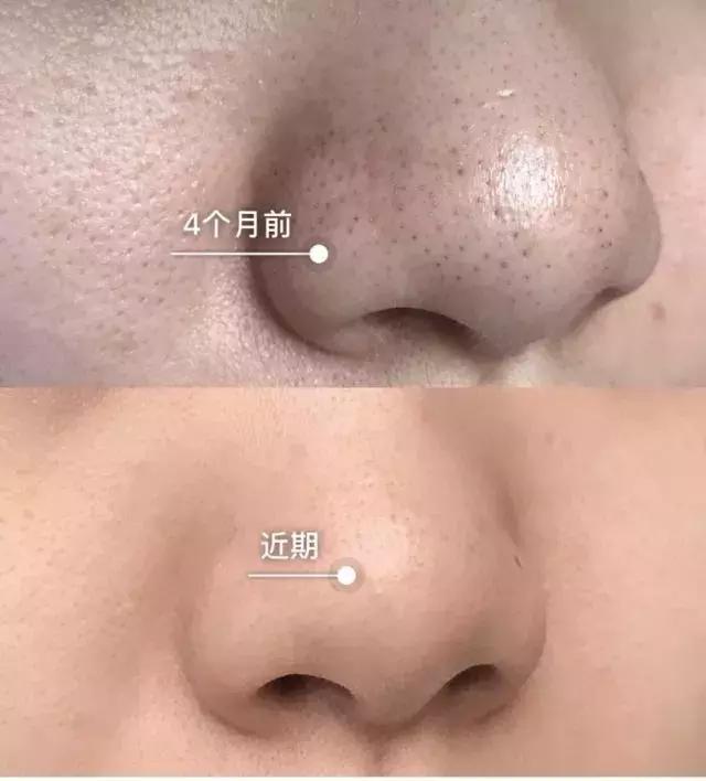 杩欎釜澶忓涓嶈鏌撶殑鍙戣壊,涓嶈绮楁瘺瀛旇刀璧拌崏鑾撻蓟