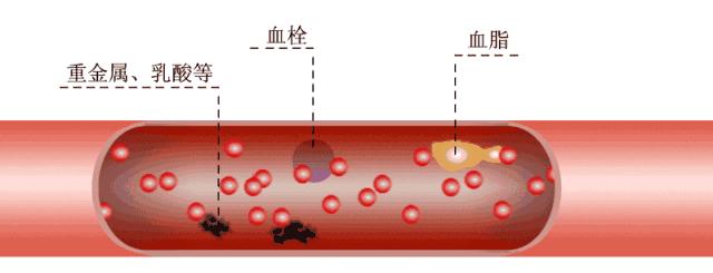 血管干净的十个好方法,你的血管健康么