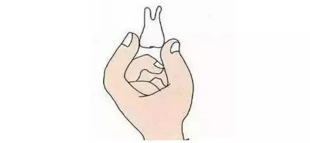 掉了颗牙一直流血,掉整颗牙啥原因