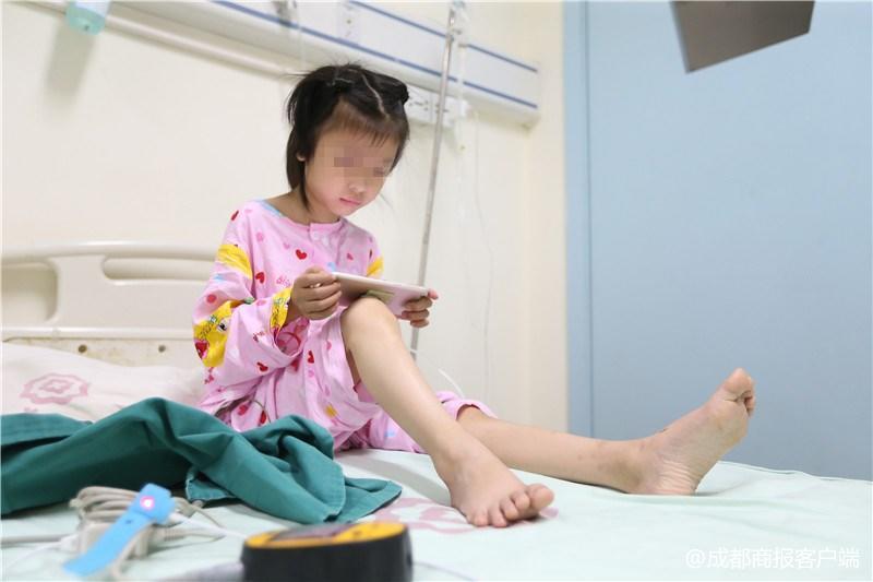 误食强碱灼伤食道后续,误食强碱灼伤食道的后果