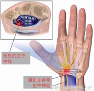 中年女性手麻手抖,女中老年人手麻是什么原因