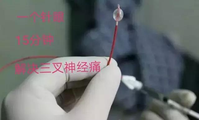 你的脸疼到不想要，神经外科专家却说：“十五分钟就能搞定”