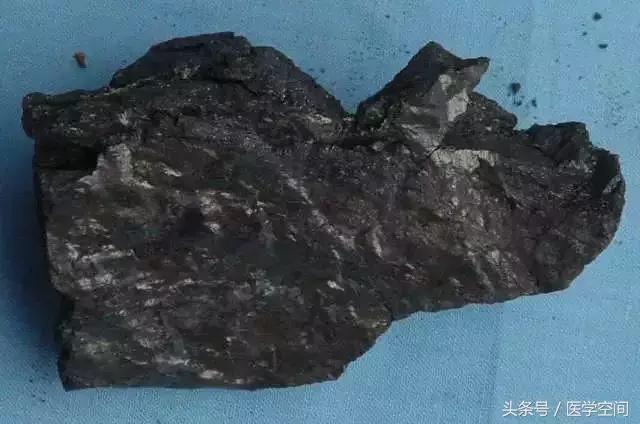 美国癌症协会公布九大防癌建议 (美国癌症协会公布9大防癌建议)