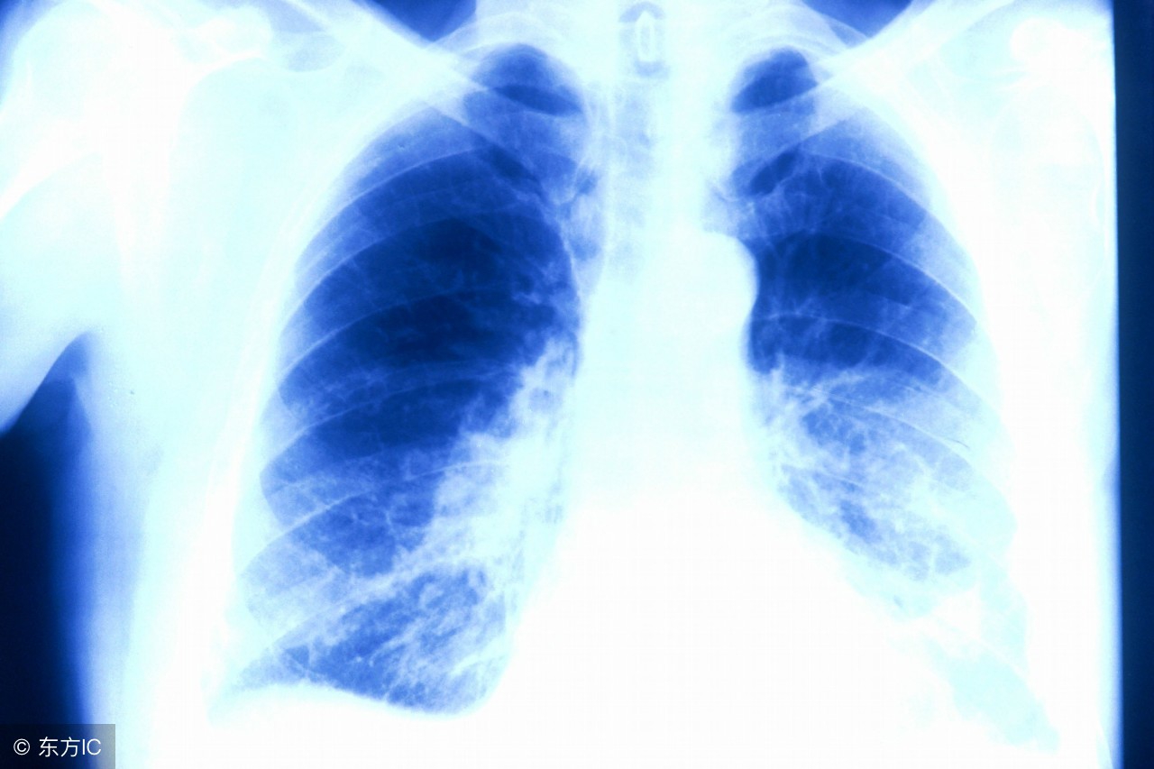 肺结核停药4个月怀孕能要吗,吃肺结核药对怀孕有影响吗