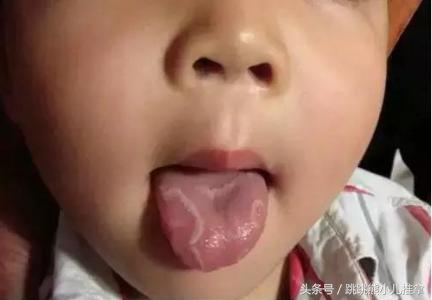 怎么看宝宝舌头是否积食,宝宝积食的舌头是怎样的