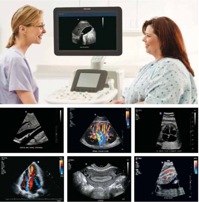 妇科b超可以不用憋尿吗,妇科b超可以检查到癌细胞吗