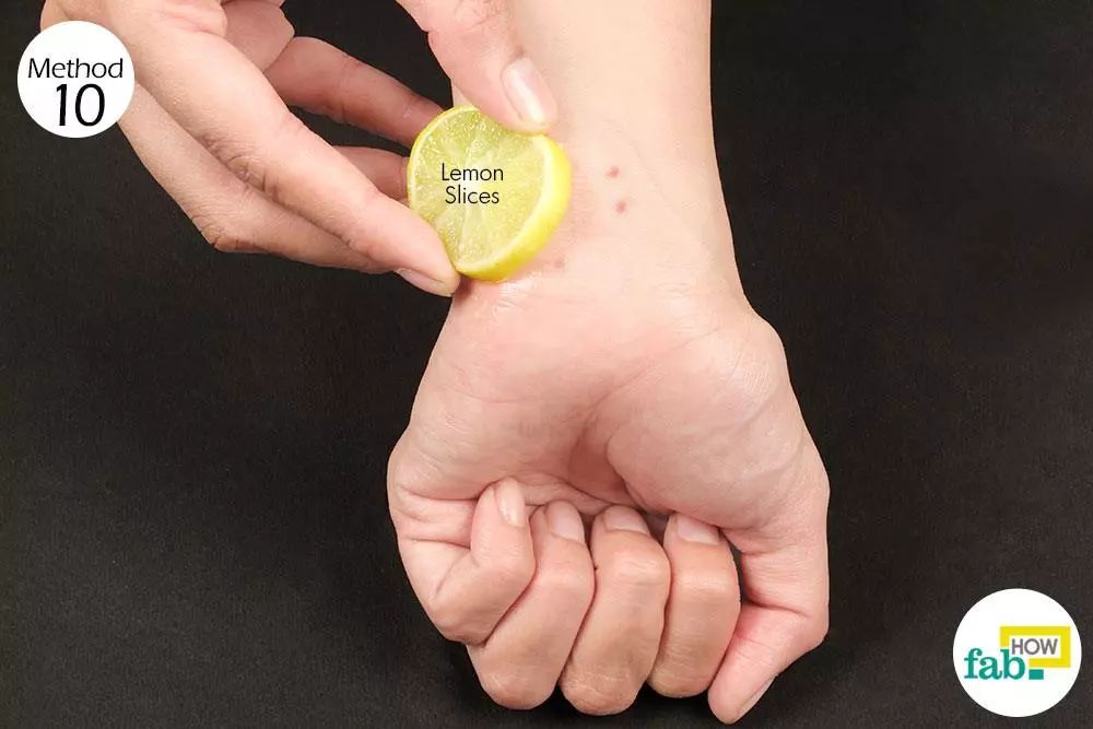 使用！总被蚊子咬？涂点这个马上止痒