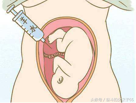 怀孕缺水一直口干,怀孕总是觉得缺水