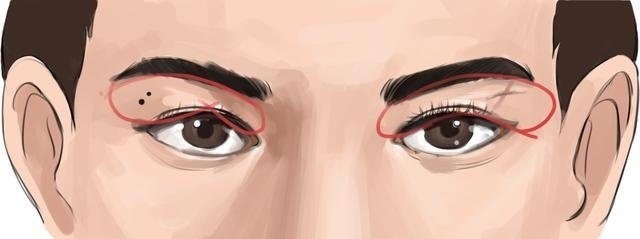 面相好痣和恶痣的区别图片,面相中女人眉毛之间有痣代表什么