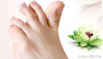 脚气病平时要注意什么,脚气有什么不可以吃的