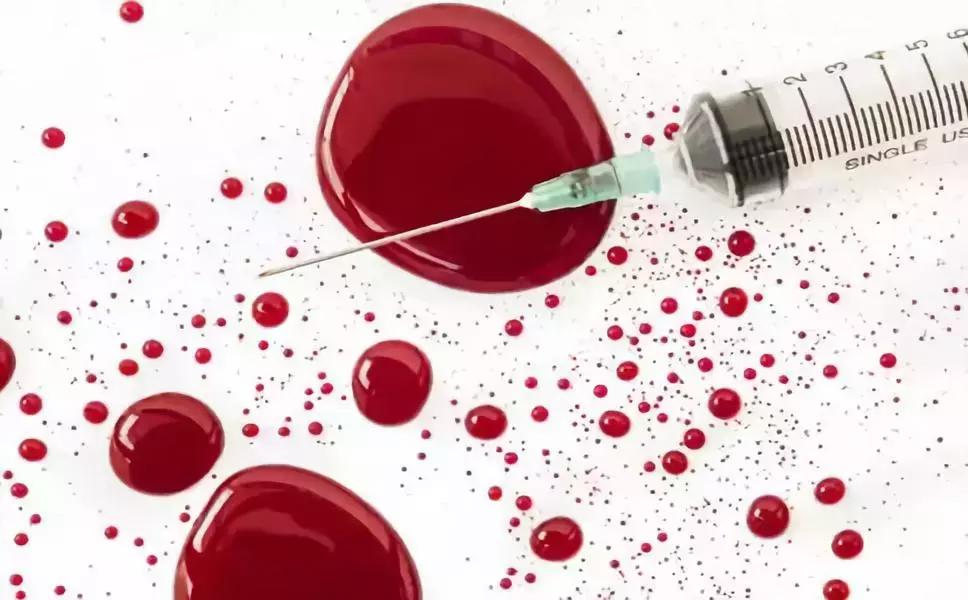 浙江医生违规操作致5人患艾滋病,18岁少女恶意传染艾滋病被判5年