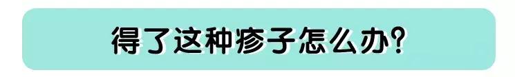 宝宝丘疹性荨麻疹后留下的红印子,宝宝身上出现红色荨麻疹