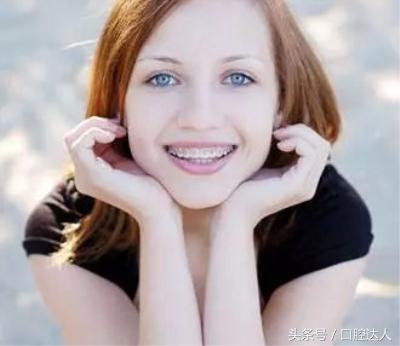 戴隐形牙套吃饭可以正常饮食吗,戴牙套饮食上该注意什么